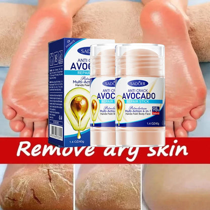 60% Urea Foot Cream Aloe Vera Ultra-hydrating Softening Dry Cracked Feet Cream Gentle Exfoliation Daily Foot Care Solution 40g