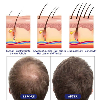 East Moon Natural Hair Growth Foam Thick Hair Care Anti Hair Loss Scalp Care Repair Hair Roots Beauty Health For Men Women