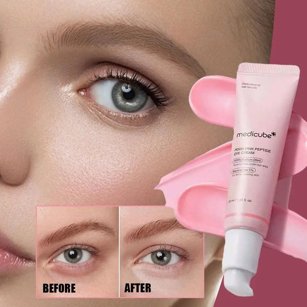 Pink Peptide Eye Cream Retinol Brightening Cream Deeply Repairs Skin Effectively Improves Firmness Fades Fine Lines Eyecare