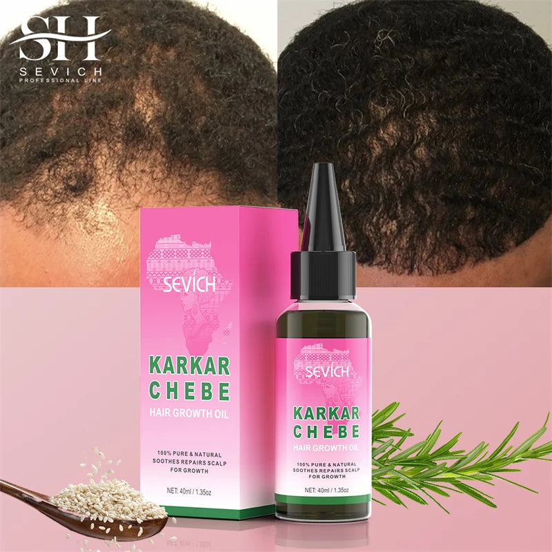 2024 New Super Growth Oil Karkar Regrowth Thicken Oils Chebe Anti-Breakage Essential Oil Serum Rosemary Anti Hair Loss Products