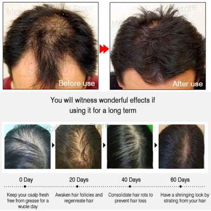 7 Days Fast Hair Growth Serum Ginger Anti Hair Loss Essential Oil Promote Regrowth Thicken Hair Care For Men Women Beauty Health