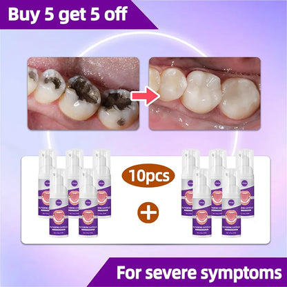 tooh Decay repair Suitable for all ages