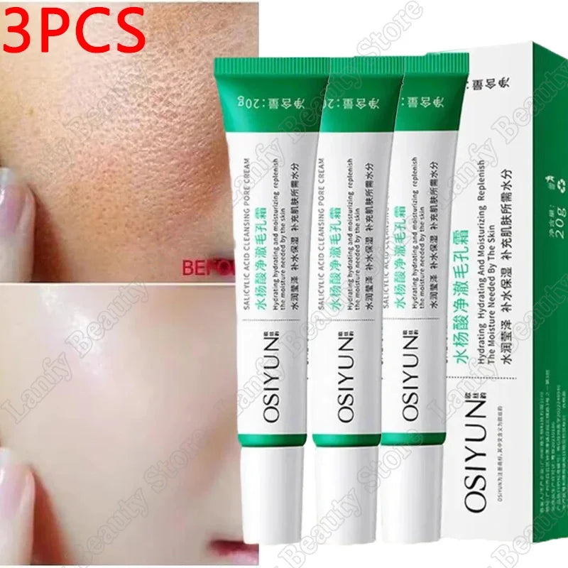 Salicylic Acid Pore Clearing Cream Shrink Pores Remove Blackheads Acne Brighten Moisturizing Smooth Skin Care Korean Products