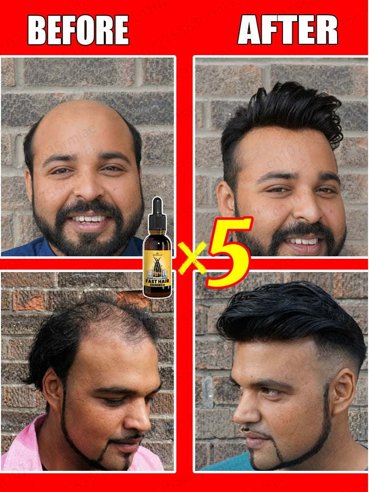 Double hair growth essential oil, the result of plant essence research, say goodbye to baldness and hair loss, without harming t