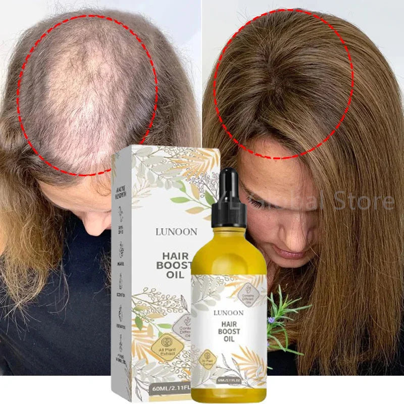 Rosemary Hair Growth Serum Anti Hair Loss Baldness Fast Regrowth Hair Care Oil Repair Damaged Hair Scalp Treatment For Women Men