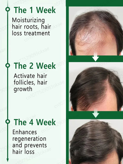 2025 bestseller, Hair growth oil for men, accelerates hair growth, no longer troubled by baldness, increases hair volume