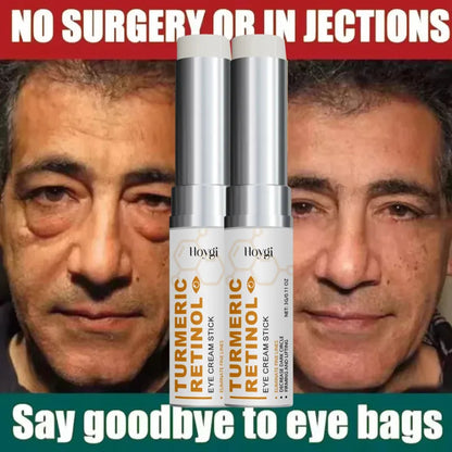 Instant Eye Bag Remove Eye Cream Anti Fat Particles Dark Circles Puffiness Fade Fine Lines Lift Brighten Korean Beauty Eye Care