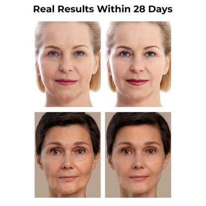 Remove Wrinkle Fine Lines around the Eyes Anti-wrinkle facial serums reducing sagging and drooping Enhances Skin Elasticity