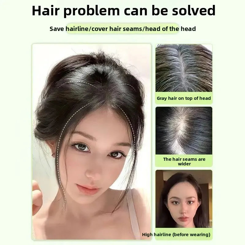 Natural Female Parting Hair Frontal Piece 3D Simulation Thickened Baldness Treatment Mid Split High Forehead Hair Extension