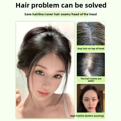 Natural Female Parting Hair Frontal Piece 3D Simulation Thickened Baldness Treatment Mid Split High Forehead Hair Extension