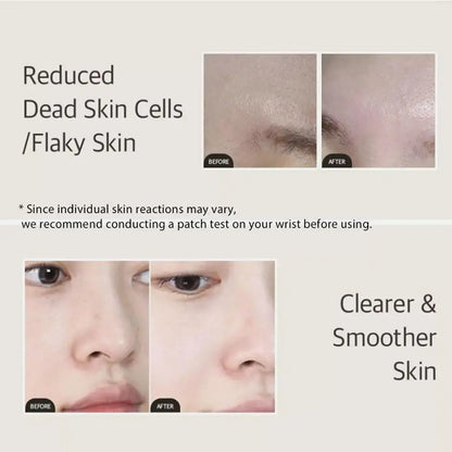 For Mixsoon Soybean Essence Repair Damage High-end Korean Facial Serum  Anti-aging Fade Spots Remove Horniness Skin Care 50ML