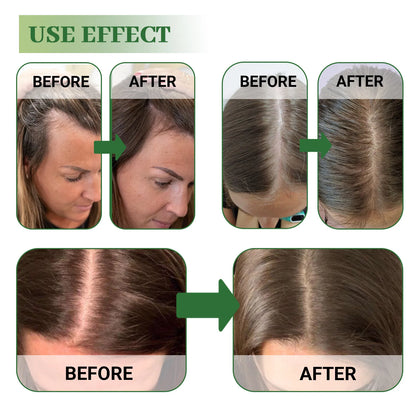 Rosemary Mint Hair Growth Oil Hair Roots Scalp Treatment Improve Androgenetic Alopecia Scalp Care Serum Strengthen Hair Roots