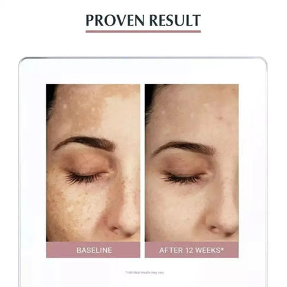 facial cleanser hand cream Deep cleansing Moisturizing prevent dryness roughness High-efficiency sun protection  skin care