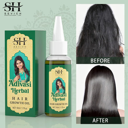 Ayurvedic Hair Growth Oil India Adivasi Organic Hair Growth Serum Anti Hair Loss Fast Regrowth Thicken Oils Hair Growth Products