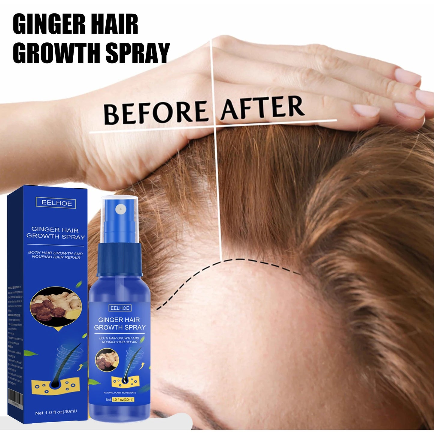Ginger Hair Growth Serum Spray Essence Prevent Hair Loss Scalp Treatment Improve Alopecia Strengthening Roots Hair Care Fluid
