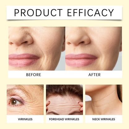 Retinol Facial Tightening Essence Deep Moisturizing Eye Periocular Fade Fine Lines Tightening Repair Hyaluronic Acid Essence