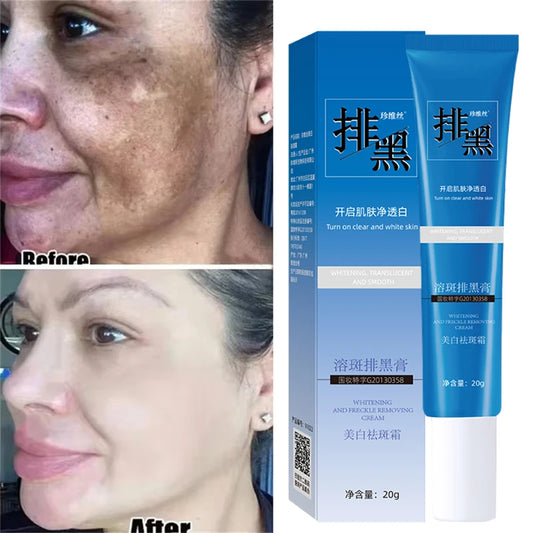 Dark Spots Removal Cream Facial Whitening Freckle Acne Mark Pigmentation Removal Melanin Skin Correction Brighten Care Products