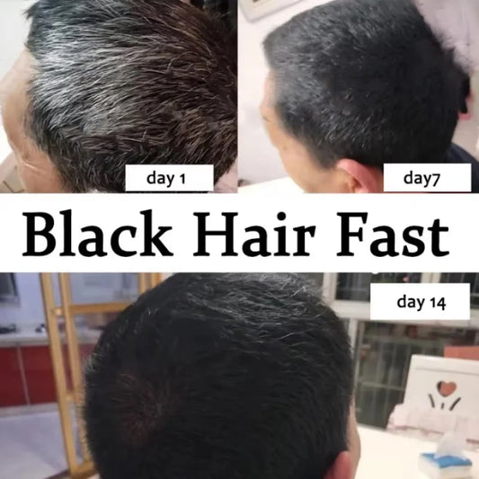 Gray White Hair Treatment Serum Cover White Hair To Black Natural Color Repair Spray Anti Loss Hair Restore Healthy Hair Care