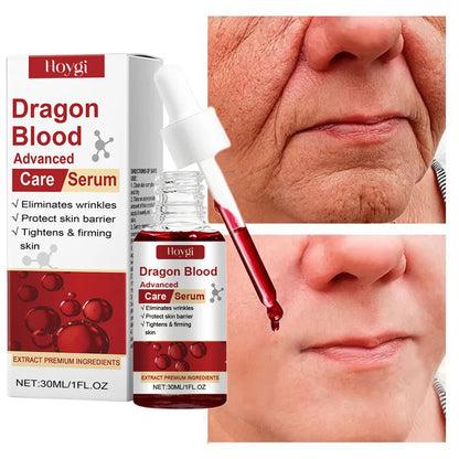 Dragon Blood Advanced Serum Effective Resist Aging Tighten Skin Reduce Wrinkles Brighten Skin Tone Improve Dullness Face Essence
