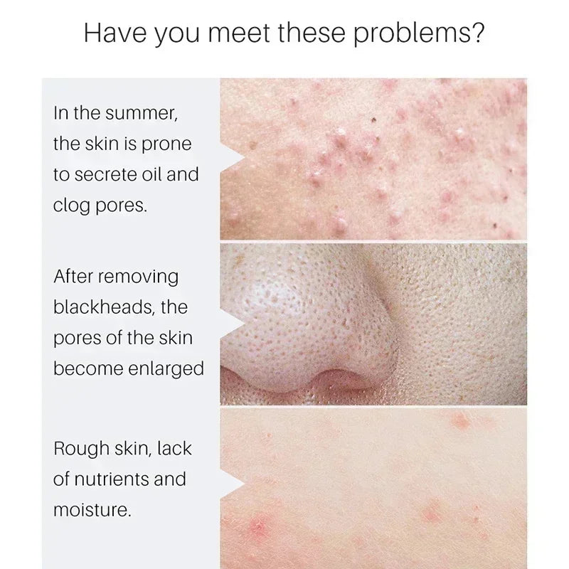 Lactic Acid Large Pores Removal Serum Facial Fast Eliminate Pore Shrinking Essence Firm Skin Moisturizing Hydration Care Product