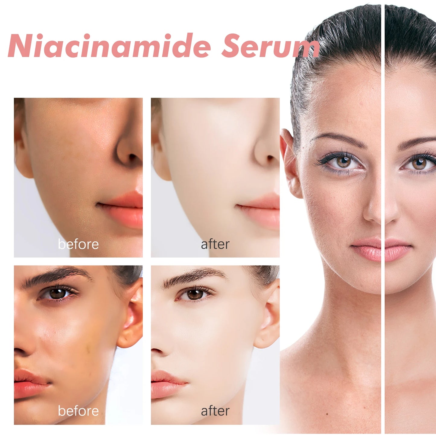 Niacinamide Facial Serum Fade Melanin Moisturzing Rejuvenation Shrink Pores Smooth Brightening Skin Care Dark Spot Remover Serum
