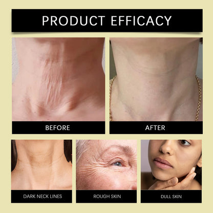 Hoygi Bee Venom Firming Serum Stick Anti Wrinkle Cream Lifts Tightens the Skin Solving Wrinkles Fine Lines Natural Serum