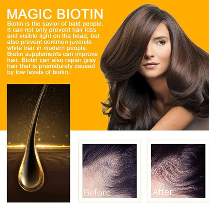 1/3/5Pcs Products Biotin Thickening Fast Growing Hair Care Essential Oils Anti Hair Loss Spray Scalp Treatment For Men Women