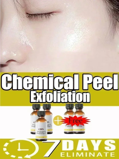 Salicylic Acid Face Facial Peel Neutraliser Face Deep At Home Chemical Peel Exfoliate Refine skin care serum NEW