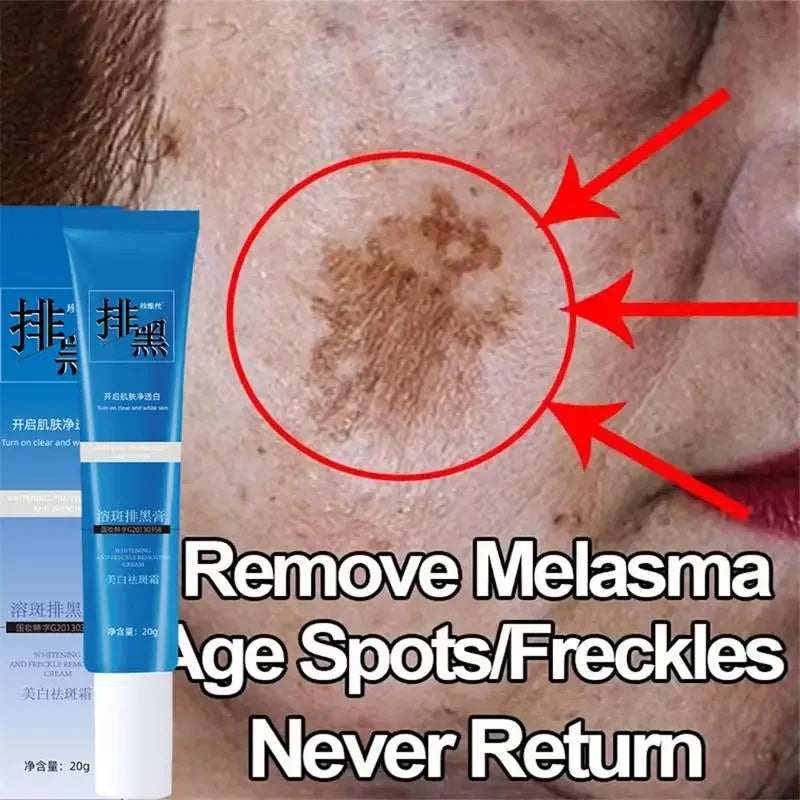 Dark Spots Removal Cream Facial Whitening Freckle Acne Mark Pigmentation Removal Melanin Skin Correction Brighten Care Products