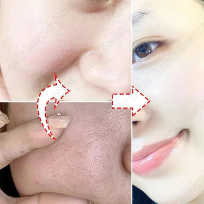 Salicylic Acid Pore Clearing Cream Shrink Pores Remove Blackheads Acne Brighten Moisturizing Smooth Skin Care Korean Products