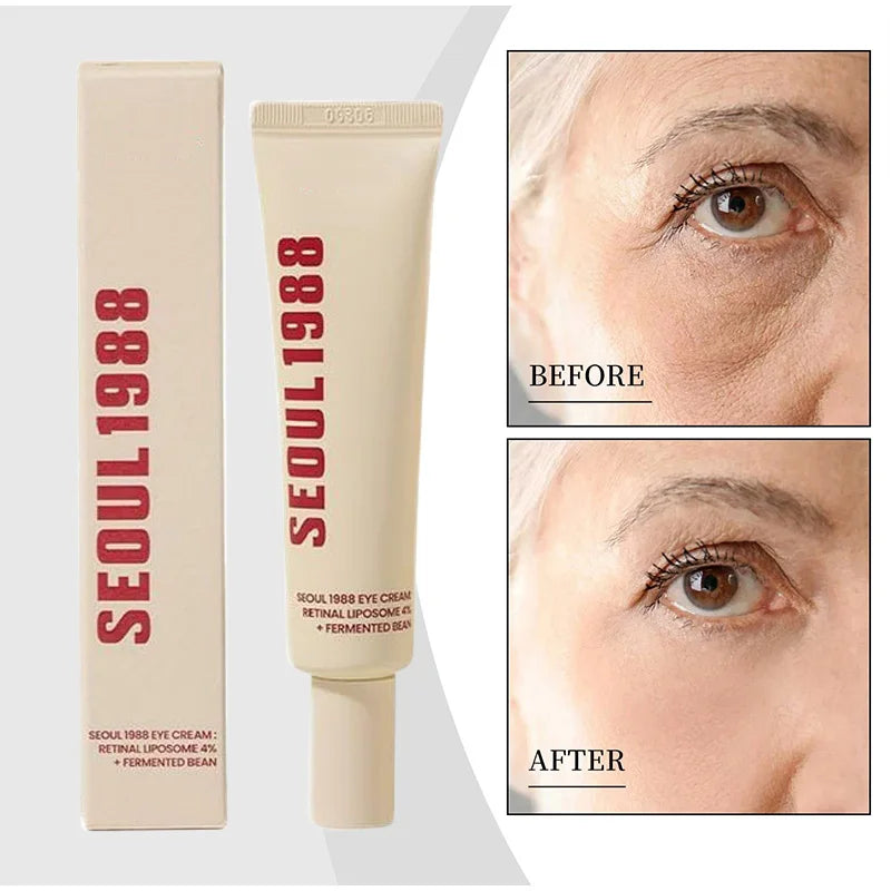 Instant Eye Bag Removal Cream SEOUL 1988 Retinol Anti-Wrinkle Lifting Firming Fade Fine Line Anti Dark Circle Puffiness Eye Care