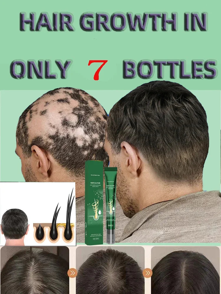 Hair Growth Oil Effective Baldness Repair Hereditary Postpartum Seborrheic Hair Loss for Women & Men Fast Hair Growth Oil
