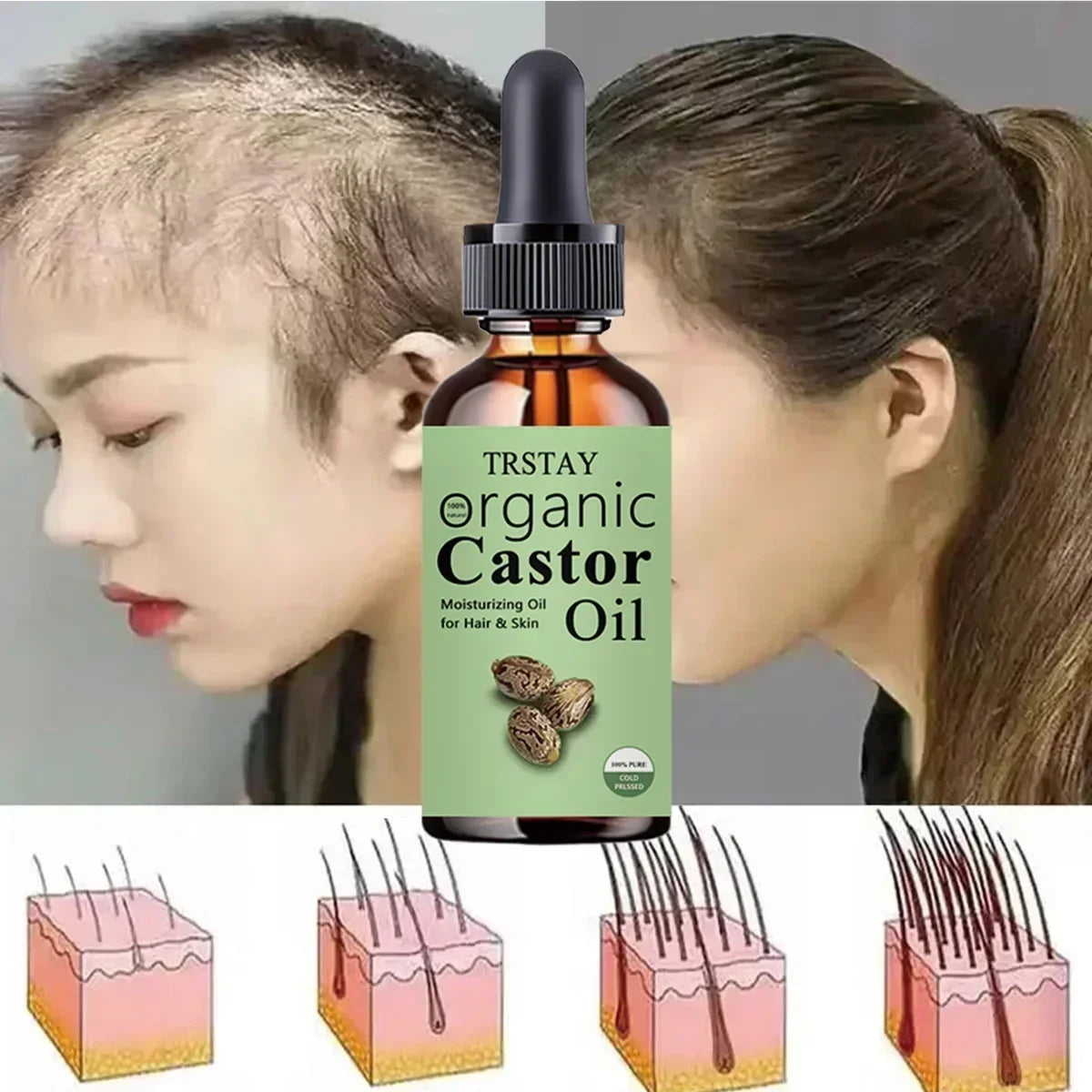 TRSTAY 100% PURE CASTOR OIL Hydrating Skin with Castor 0il Excellent Natural Skin Moisturizer