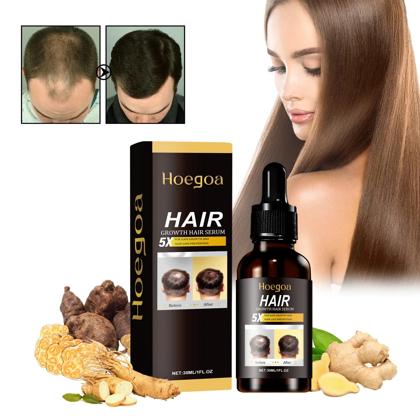 Hair Care Serum Oil Ginger Hair Regrowth Anti-Hair Loss Repairing Nourish Damaged Hair Roots Dense Essence Hair Conditioner