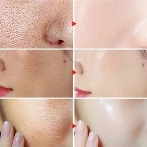 Lactic Acid Large Pores Removal Serum Facial Fast Eliminate Pore Shrinking Essence Firm Skin Moisturizing Hydration Care Product