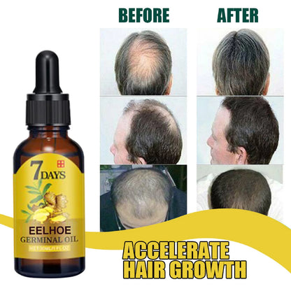Ginger Hair Care Oil Hair Roots Scalp Treatment Improve Androgenetic Alopecia Scalp Treatment Serum Strengthen Hair Roots