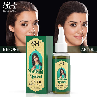 Ayurvedic Hair Growth Oil India Adivasi Organic Hair Growth Serum Anti Hair Loss Fast Regrowth Thicken Oils Hair Growth Products