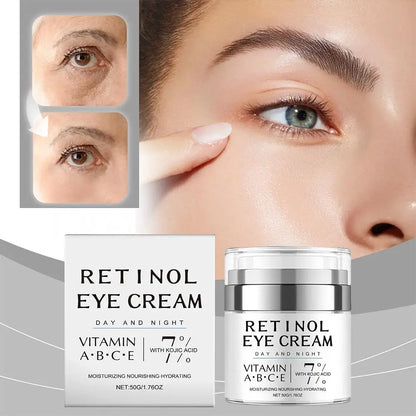 Retinol Eye Cream Anti Aging Eye Treatment Dark Circles Reduces Fine Lines Tightens The Skin Gently Nourishes Brighten Eye Care