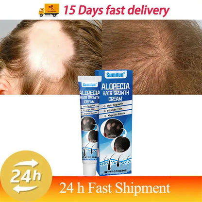 7 days Fast Hair Growth Cream Anti Hair loss Prevent Baldness Scalp Treatment Repair Roots Beauty Health Hair Care For Men Women