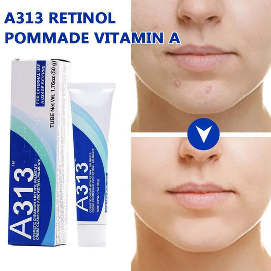 A313 Retinol Pommade Vitamin A Reduce Fine Lines And Wrinkles Night Mousturizer Deeply Nourishing Firming And Smoothing Skin