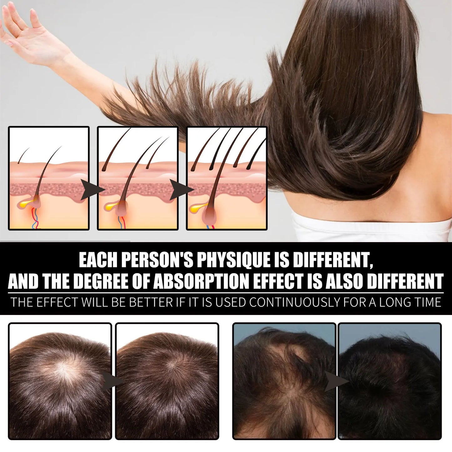 Ouhoe 30ml Collagen Hair Growth Oil for Thinning Hair Anti Hair Loss Deep Nourishing Serum Promotes Regrowth Reduces Shedding