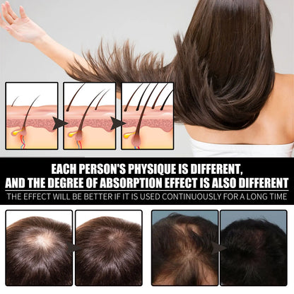 Ouhoe 30ml Collagen Hair Growth Oil for Thinning Hair Anti Hair Loss Deep Nourishing Serum Promotes Regrowth Reduces Shedding