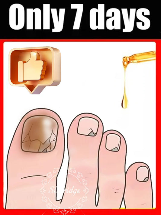 2025 Toenail Fungus Patch Waterproof Nail Repair Patches Nail Ingrown Correction Sticker Discolored Damaged Nail Foot Care Tool