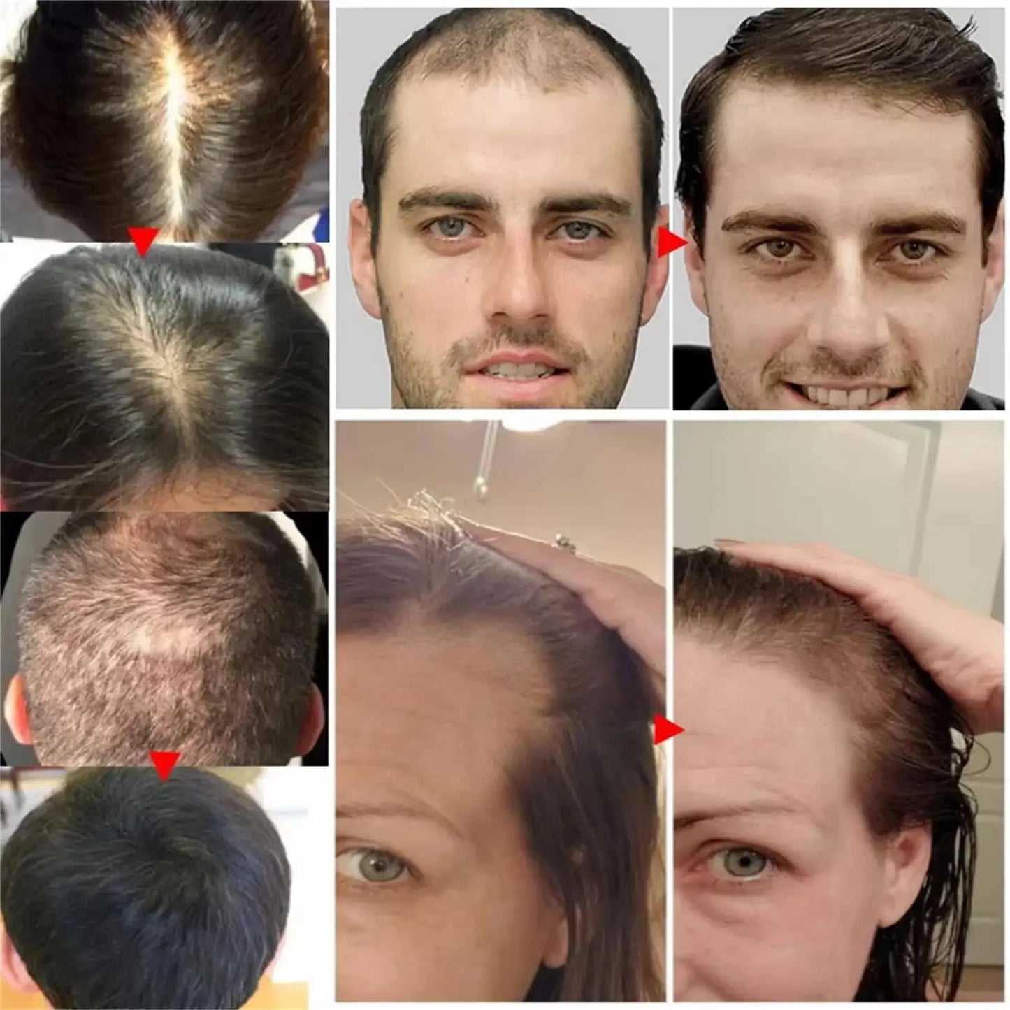 Fast Hair Growth Set Batana Oil Traction Alopecia Hair Mask Anti Break Loss Hair Growth Oil Baldness Treatment Hair Health Care