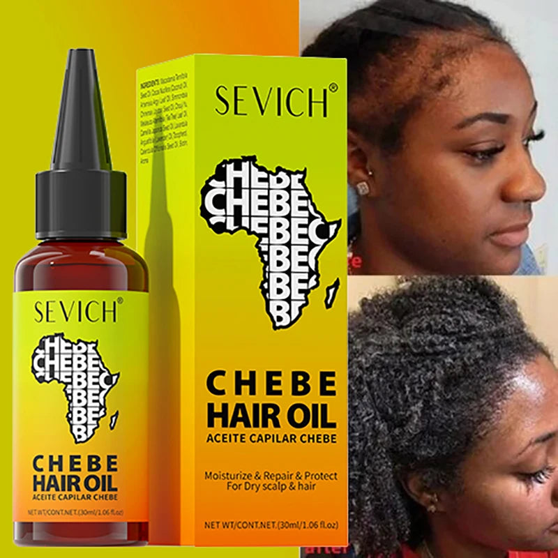 Chebe Fast Hair Growth Oil Hair Regrowth Growth Oil Anti Hair Loss Chebe Hair Mask Repair Damaged Strengthen Anti Hair Break