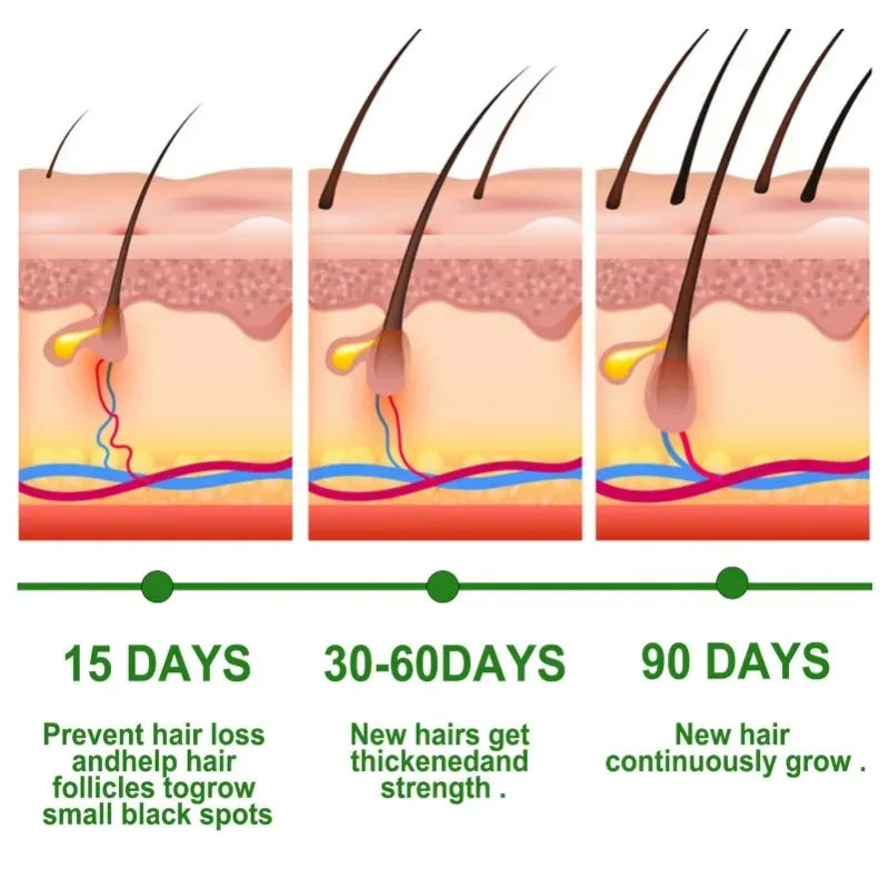 EELHOE Rosemary Essential Oil Nourishes Repairs Improves Frizz Prevents Hair Loss Eliminates Itching Thinning Damaged Hair Care