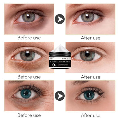 Instant Remove Wrinkles Retinol Face Cream Lifting Anti Aging Anti Eye Bags Moisturizer Facial Treatment Korean Care