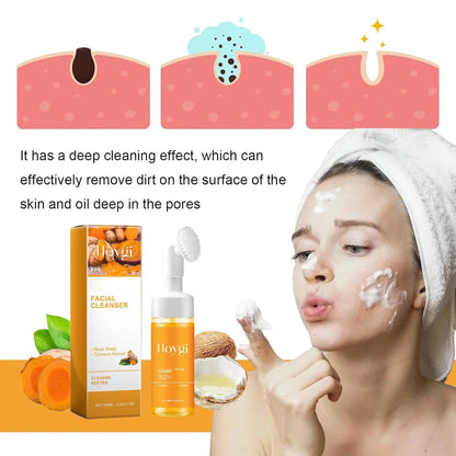 Turmeric Kojic Acid Blackhead Remover Cleanser Deeply Cleansing Skin Cleansing Oil Control Fade Acne Marks Brighten Foam Cleanse