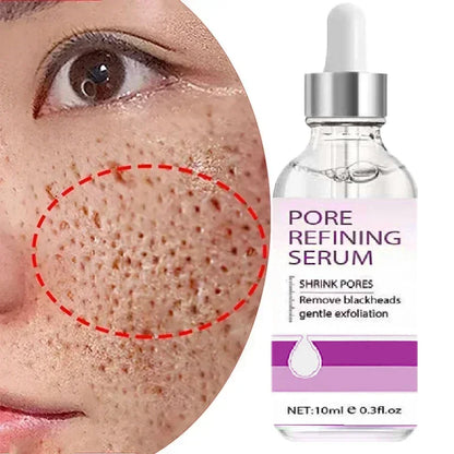 Skin Texture | Pore Refining Resurfacing, Brightening Facial Serum with Retinol and Niacinamide Non-Comedogenic