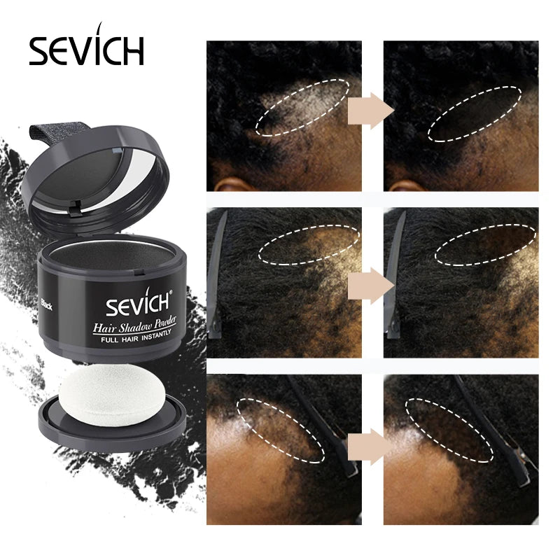 Sevich Waterproof Hair Line Powder 4g Natural Instant Hairline Shadow Powder Black Root Cover Up Forehead Hair Makeup Concealer